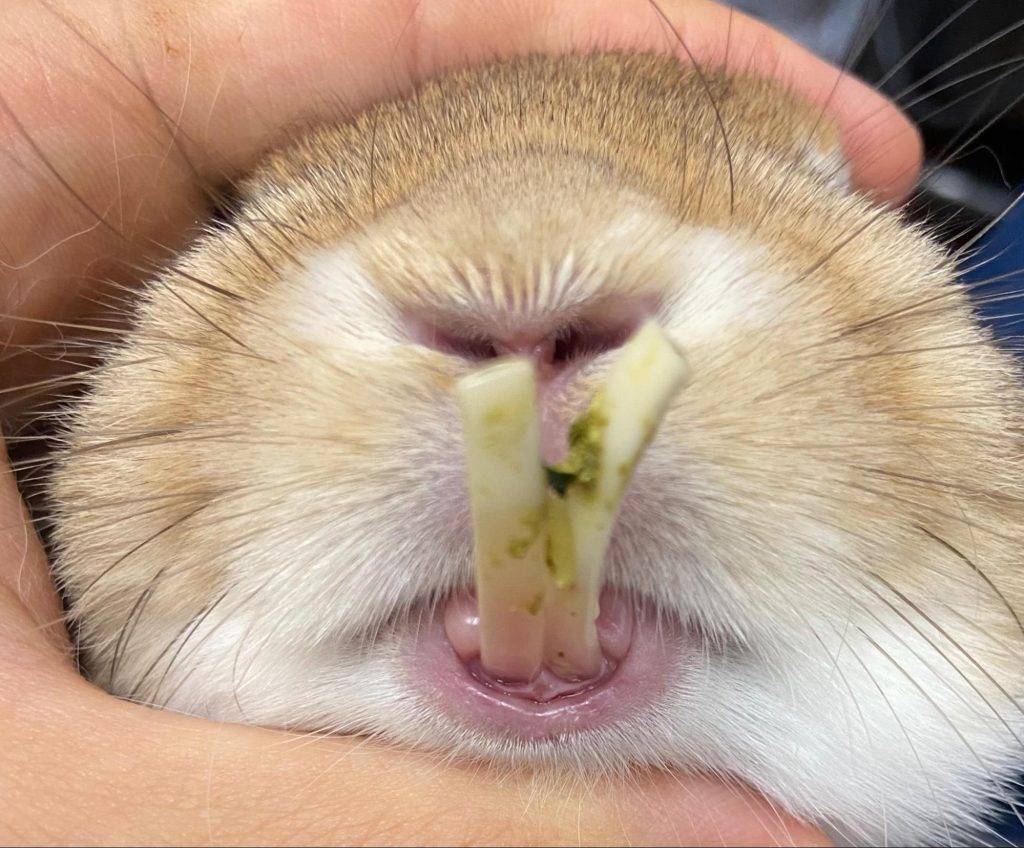 膿瘍の病態について